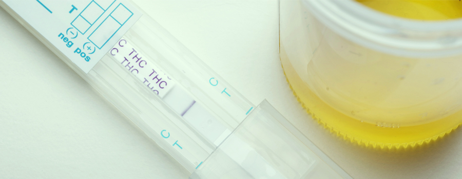 CBD E LAVORO - RISULTA NEI TEST ANTIDROGA?